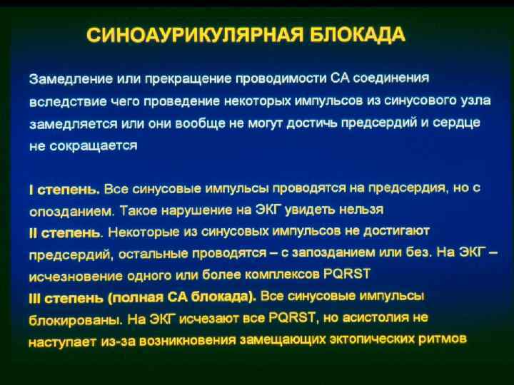 Лечение блокад. Терапия при блокаде сердца. Синоаурикулярная блокада 2 степени. Синоаурикулярная блокада 1 степени. Блокада сердца симптомы.