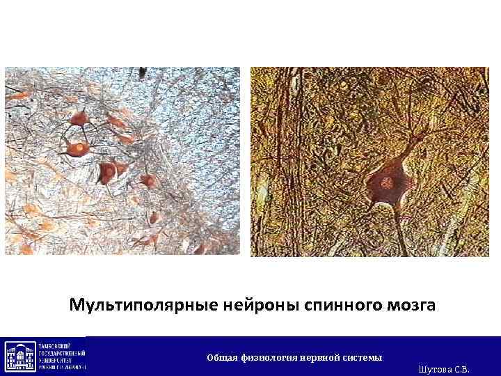 Мультиполярные нейроны спинного мозга Общая физиология нервной системы Шутова С. В. 