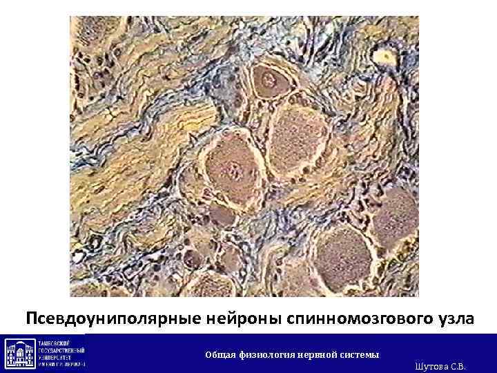 Псевдоуниполярные нейроны спинномозгового узла Общая физиология нервной системы Шутова С. В. 