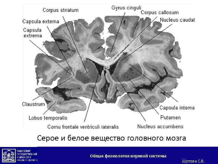 Серое и белое вещество головного мозга Общая физиология нервной системы Шутова С. В. 