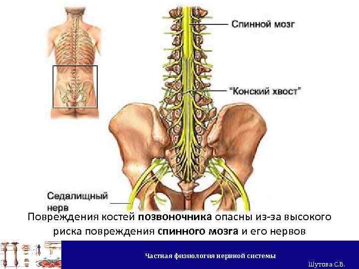 Повреждения костей позвоночника опасны из-за высокого риска повреждения спинного мозга и его нервов Частная