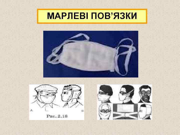 МАРЛЕВІ ПОВ’ЯЗКИ 