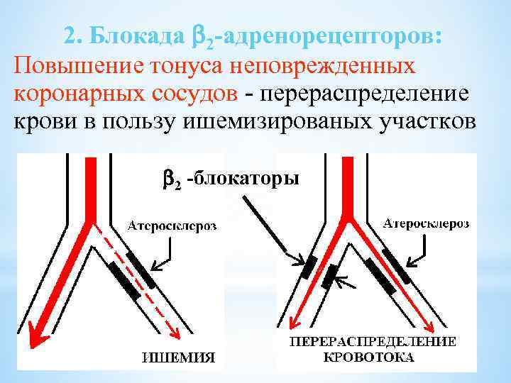 2. Блокада 2 -адренорецепторов: Повышение тонуса неповрежденных коронарных сосудов - перераспределение крови в пользу