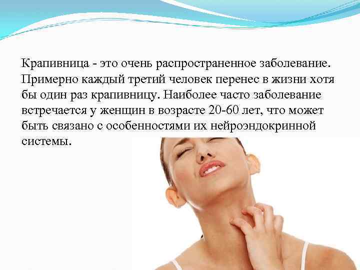 Крапивница - это очень распространенное заболевание. Примерно каждый третий человек перенес в жизни хотя