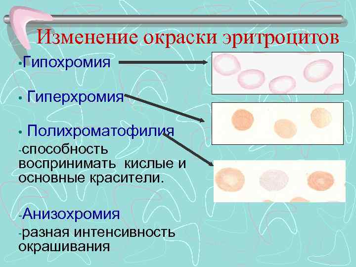 Изменение окраски эритроцитов • Гипохромия • Гиперхромия • Полихроматофилия -способность воспринимать кислые и основные