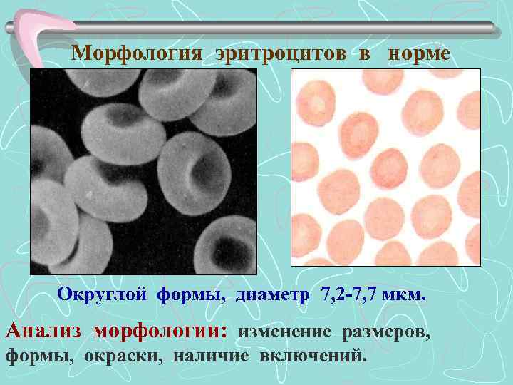 Морфология эритроцитов в норме Округлой формы, диаметр 7, 2 -7, 7 мкм. Анализ морфологии: