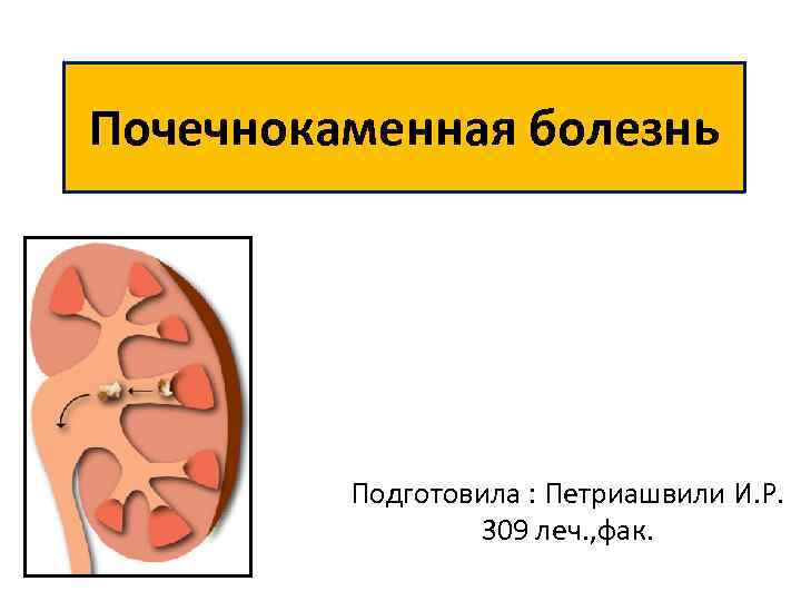 Почечнокаменная болезнь Подготовила : Петриашвили И. Р. 309 леч. , фак. 