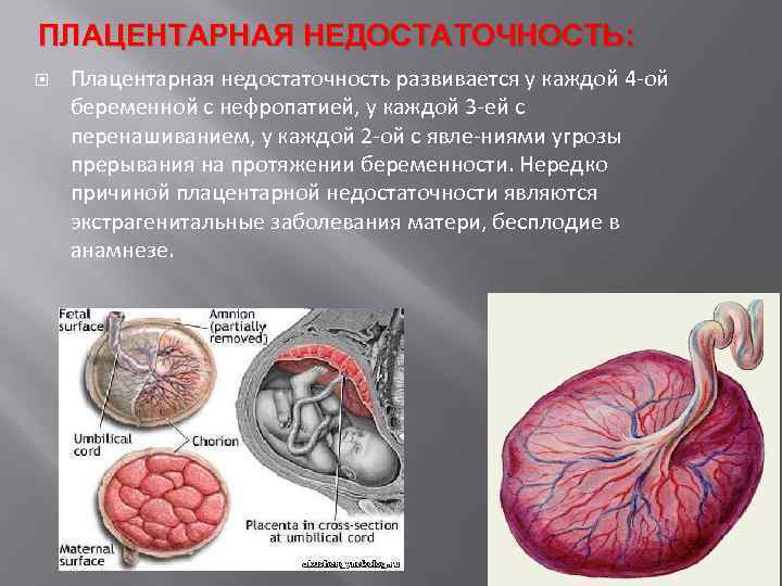 ПЛАЦЕНТАРНАЯ НЕДОСТАТОЧНОСТЬ: Плацентарная недостаточность развивается у каждой 4 ой беременной с нефропатией, у каждой