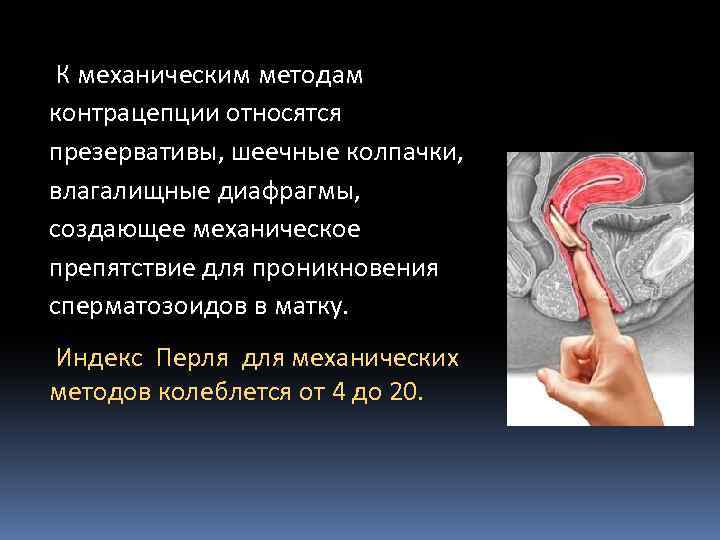  К механическим методам контрацепции относятся презервативы, шеечные колпачки, влагалищные диафрагмы, создающее механическое препятствие