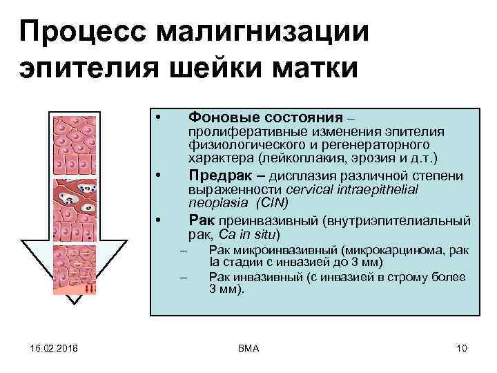 Процесс малигнизации эпителия шейки матки • Фоновые состояния – пролиферативные изменения эпителия физиологического и
