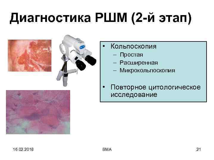 Диагностика РШМ (2 -й этап) • Кольпоскопия – Простая – Расширенная – Микрокольпоскопия •