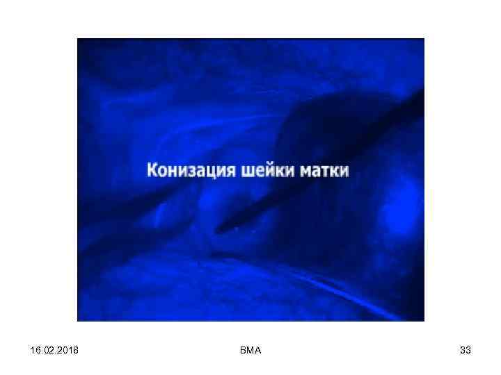 16. 02. 2018 ВМА 33 