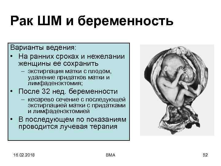 Рак ШМ и беременность Варианты ведения: • На ранних сроках и нежелании женщины ее