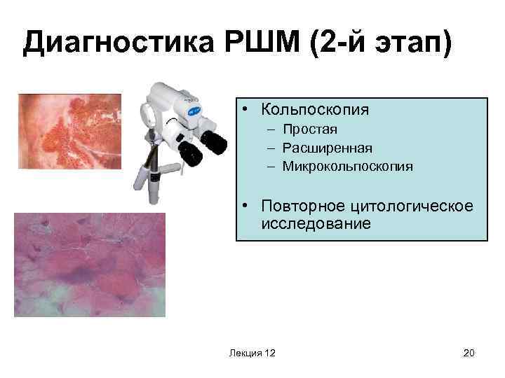 Диагностика РШМ (2 -й этап) • Кольпоскопия – Простая – Расширенная – Микрокольпоскопия •