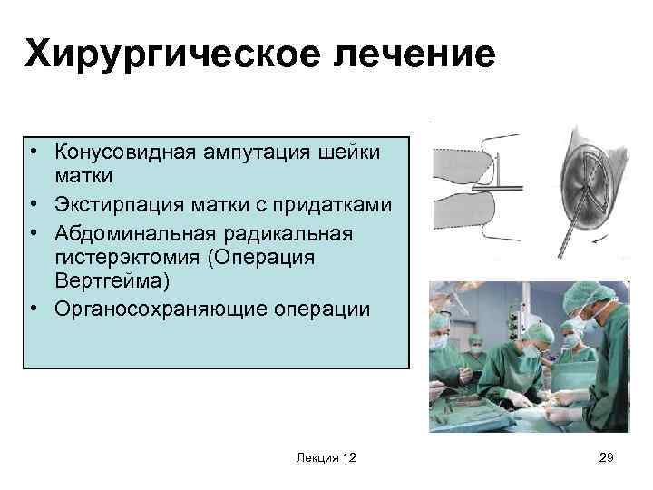 Хирургическое лечение • Конусовидная ампутация шейки матки • Экстирпация матки с придатками • Абдоминальная