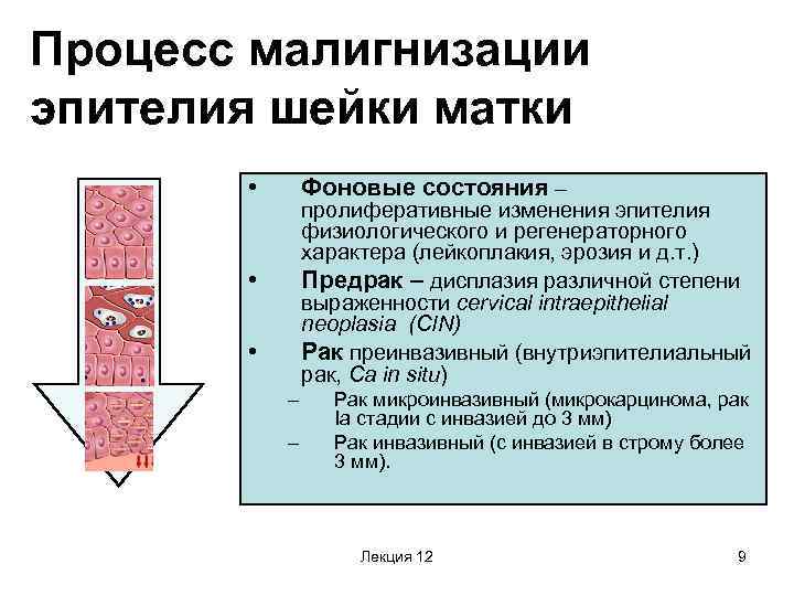 Процесс малигнизации эпителия шейки матки • Фоновые состояния – пролиферативные изменения эпителия физиологического и