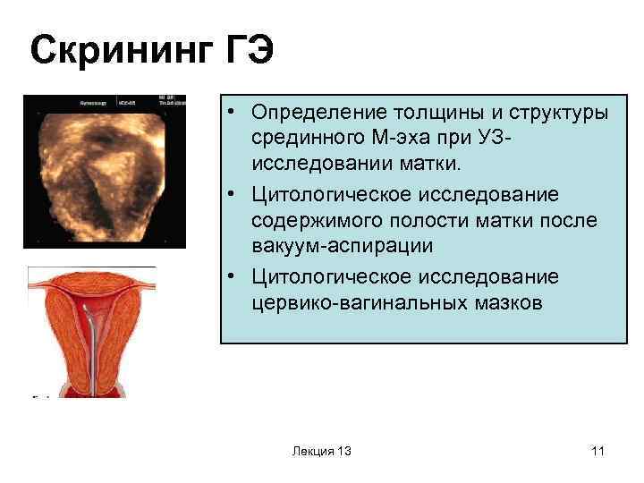 Скрининг ГЭ • Определение толщины и структуры срединного М-эха при УЗисследовании матки. • Цитологическое