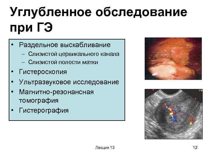 Углубленное обследование при ГЭ • Раздельное выскабливание – Слизистой цервикального канала – Слизистой полости