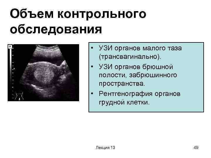 Ультразвуковое исследование органов забрюшинного пространства. УЗИ брюшного пространства. УЗИ брюшная полость и забрюшинное пространство.