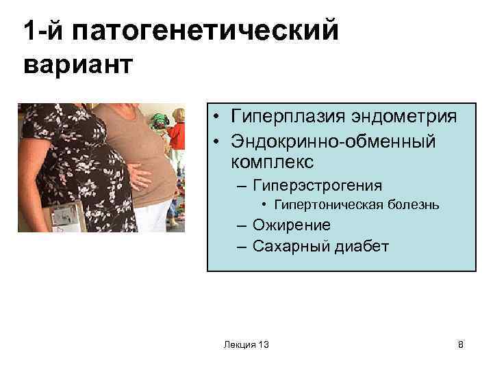 1 -й патогенетический вариант • Гиперплазия эндометрия • Эндокринно-обменный комплекс – Гиперэстрогения • Гипертоническая