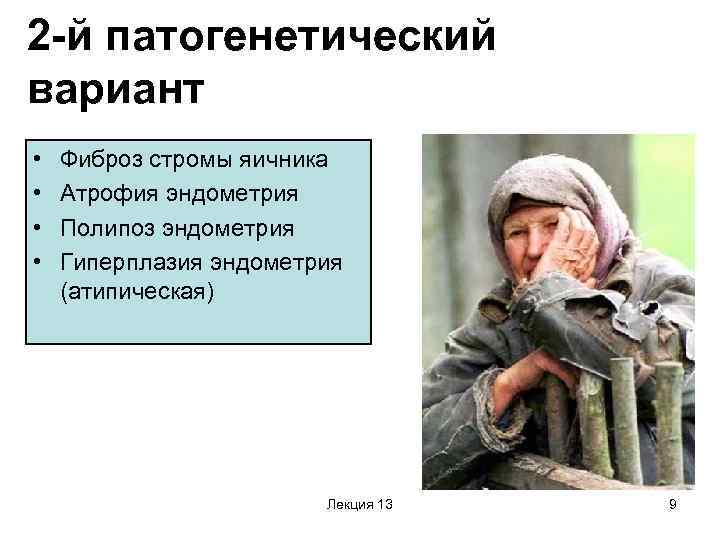 2 -й патогенетический вариант • • Фиброз стромы яичника Атрофия эндометрия Полипоз эндометрия Гиперплазия
