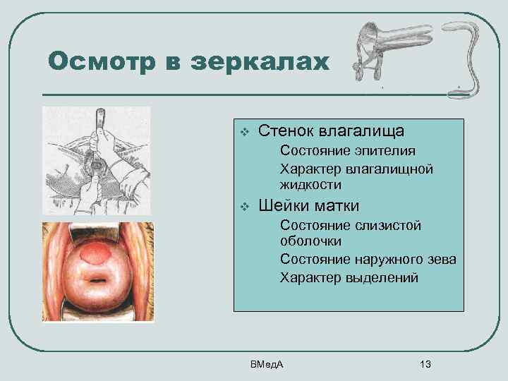 Осмотр в зеркалах v v Стенок влагалища • • Состояние эпителия Характер влагалищной жидкости