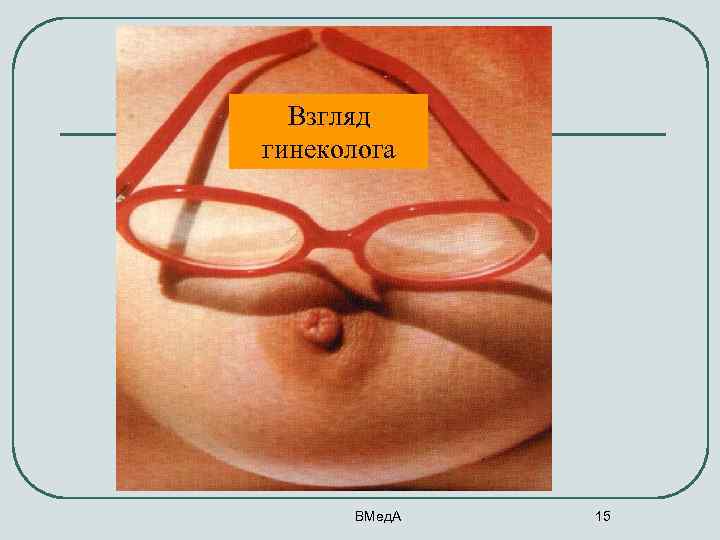 Взгляд гинеколога ВМед. А 15 