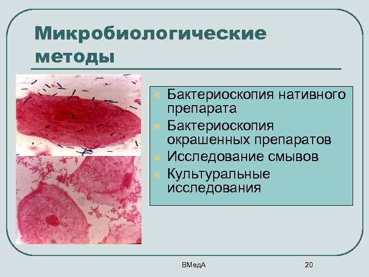 Микробиологические методы l l Бактериоскопия нативного препарата Бактериоскопия окрашенных препаратов Исследование смывов Культуральные исследования
