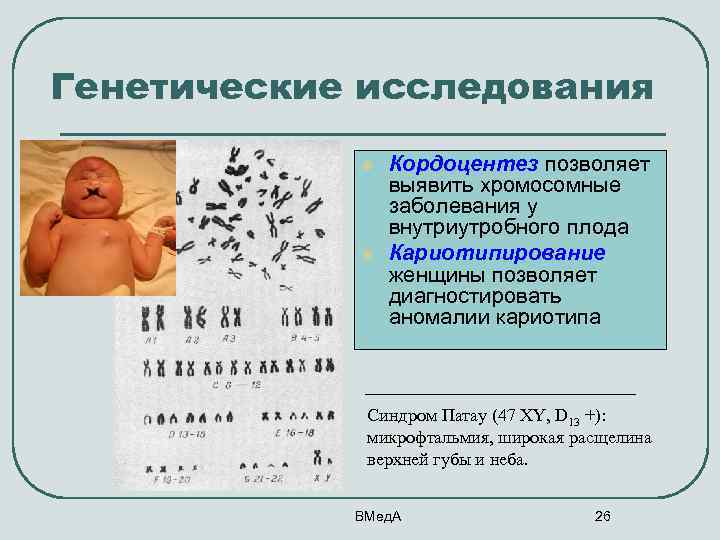 Генетические исследования l l Кордоцентез позволяет выявить хромосомные заболевания у внутриутробного плода Кариотипирование женщины