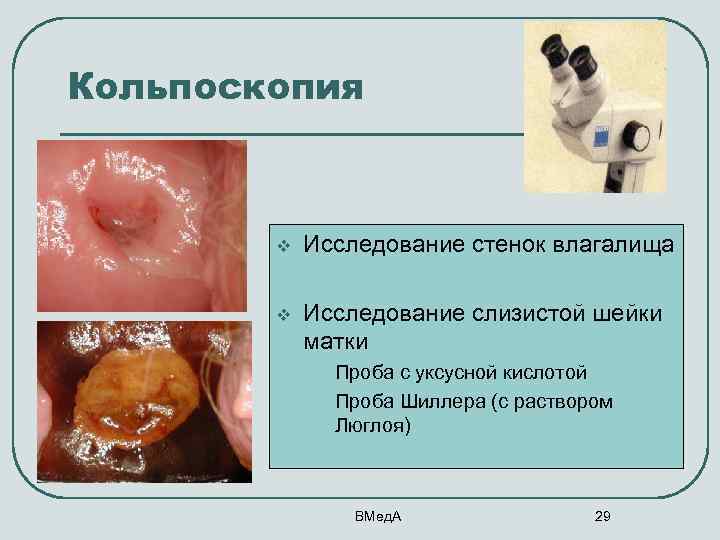 Кольпоскопия v Исследование стенок влагалища v Исследование слизистой шейки матки • • Проба с