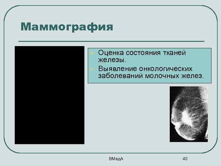 Маммография l l Оценка состояния тканей железы. Выявление онкологических заболеваний молочных желез. ВМед. А