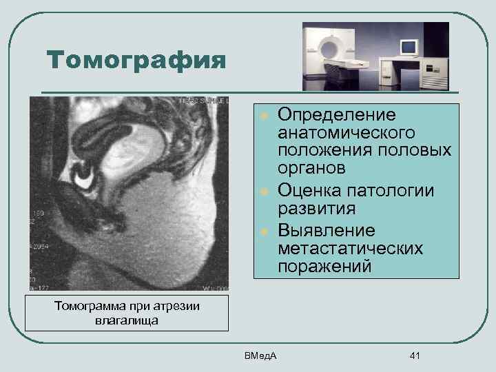 Томография l l l Определение анатомического положения половых органов Оценка патологии развития Выявление метастатических