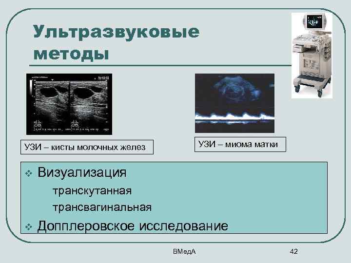 Ультразвуковые методы УЗИ – миома матки УЗИ – кисты молочных желез v Визуализация v