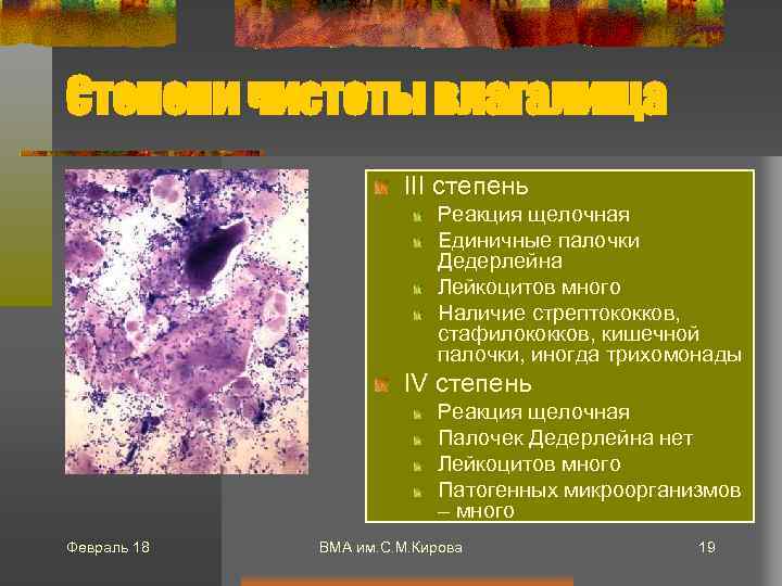 Степени чистоты влагалища III степень Реакция щелочная Единичные палочки Дедерлейна Лейкоцитов много Наличие стрептококков,