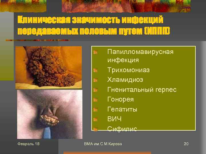 Клиническая значимость инфекций передаваемых половым путем (ИППП) Папилломавирусная инфекция Трихомониаз Хламидиоз Гненитальный герпес Гонорея