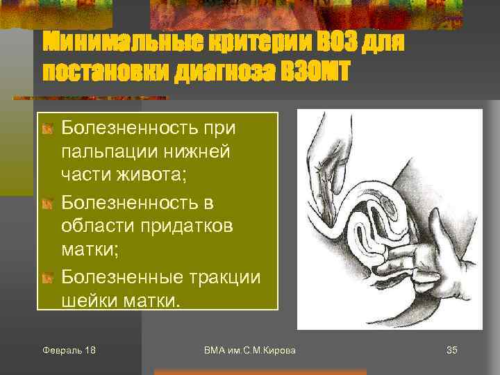 Минимальные критерии ВОЗ для постановки диагноза ВЗОМТ Болезненность при пальпации нижней части живота; Болезненность