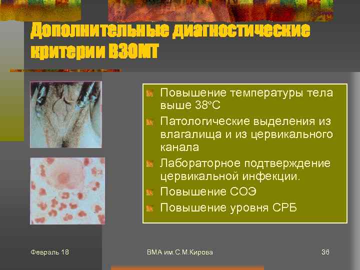 Дополнительные диагностические критерии ВЗОМТ Повышение температуры тела выше 38ºC Патологические выделения из влагалища и