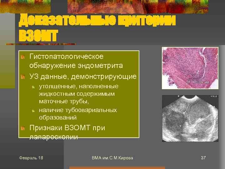 Доказательные критерии ВЗОМТ Гистопатологическое обнаружение эндометрита УЗ данные, демонстрирующие утолщенные, наполненные жидкостным содержимым маточные
