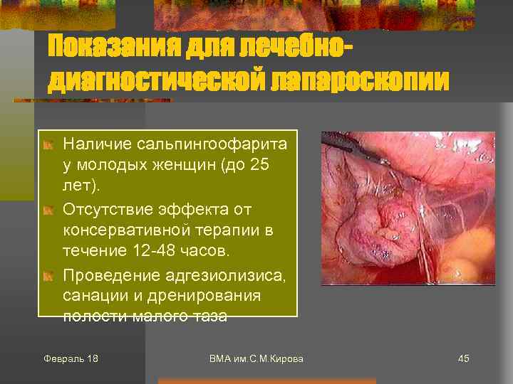 Показания для лечебнодиагностической лапароскопии Наличие сальпингоофарита у молодых женщин (до 25 лет). Отсутствие эффекта