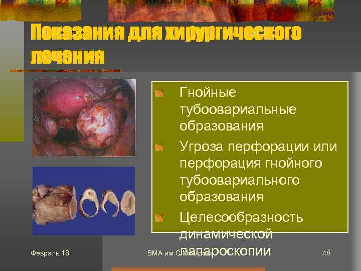 Показания для хирургического лечения Февраль 18 Гнойные тубоовариальные образования Угроза перфорации или перфорация гнойного