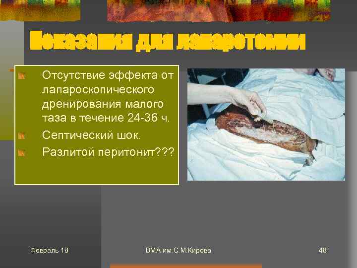 Показания для лапаротомии Отсутствие эффекта от лапароскопического дренирования малого таза в течение 24 -36