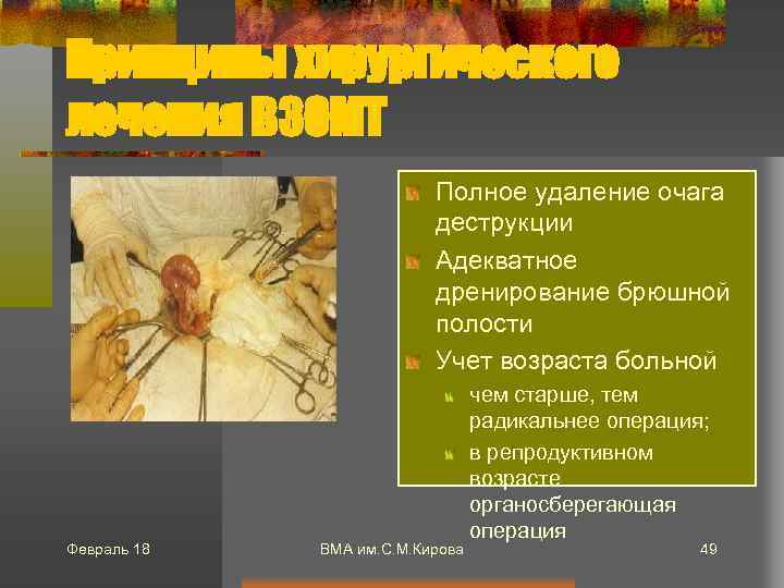 Принципы хирургического лечения ВЗОМТ Полное удаление очага деструкции Адекватное дренирование брюшной полости Учет возраста