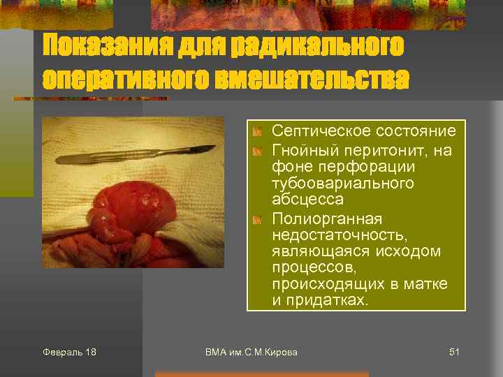 Показания для радикального оперативного вмешательства Септическое состояние Гнойный перитонит, на фоне перфорации тубоовариального абсцесса