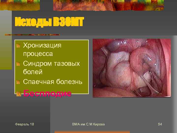 Исходы ВЗОМТ Хронизация процесса Синдром тазовых болей Спаечная болезнь Бесплодие Февраль 18 ВМА им.