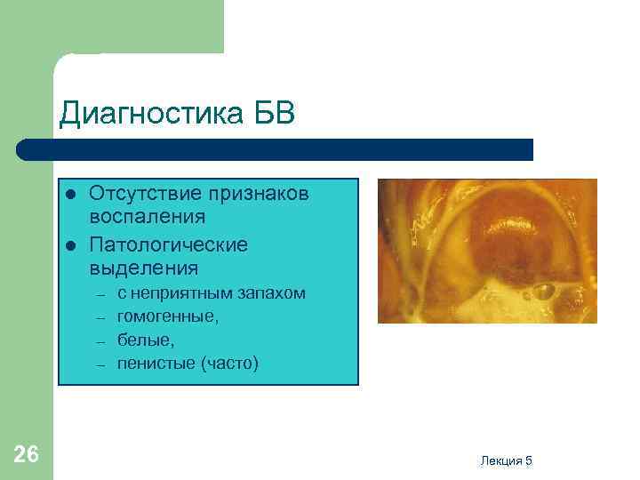 Диагностика БВ l l Отсутствие признаков воспаления Патологические выделения – – 26 с неприятным