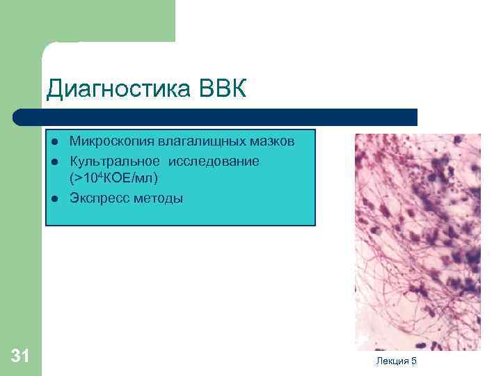 Диагностика ВВК l l l 31 Микроскопия влагалищных мазков Культральное исследование (>104 КОЕ/мл) Экспресс