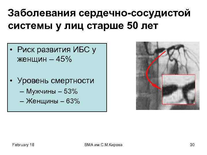 Заболевания сердечно-сосудистой системы у лиц старше 50 лет • Риск развития ИБС у женщин