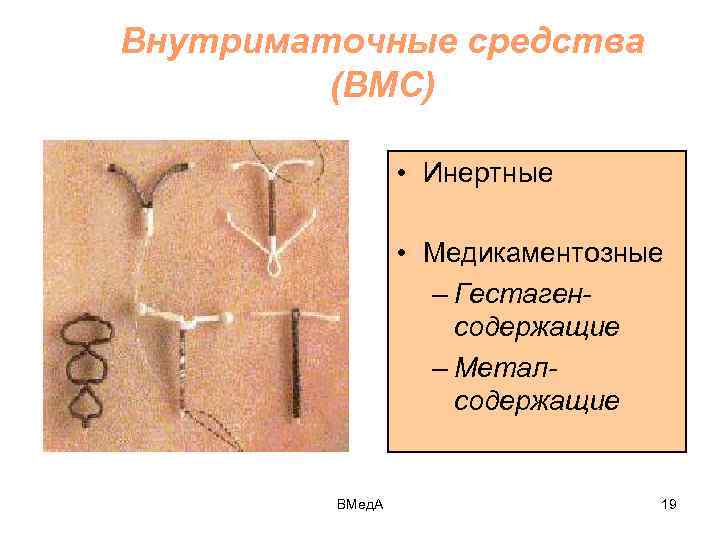 Внутриматочные средства (ВМС) • Инертные • Медикаментозные – Гестагенсодержащие – Металсодержащие ВМед. А 19