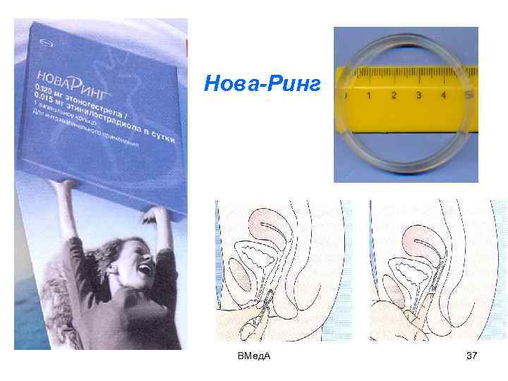 Нова-Ринг ВМед. А 37 