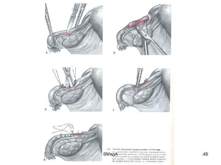 ВМед. А 48 